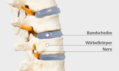 bandscheibenprobleme