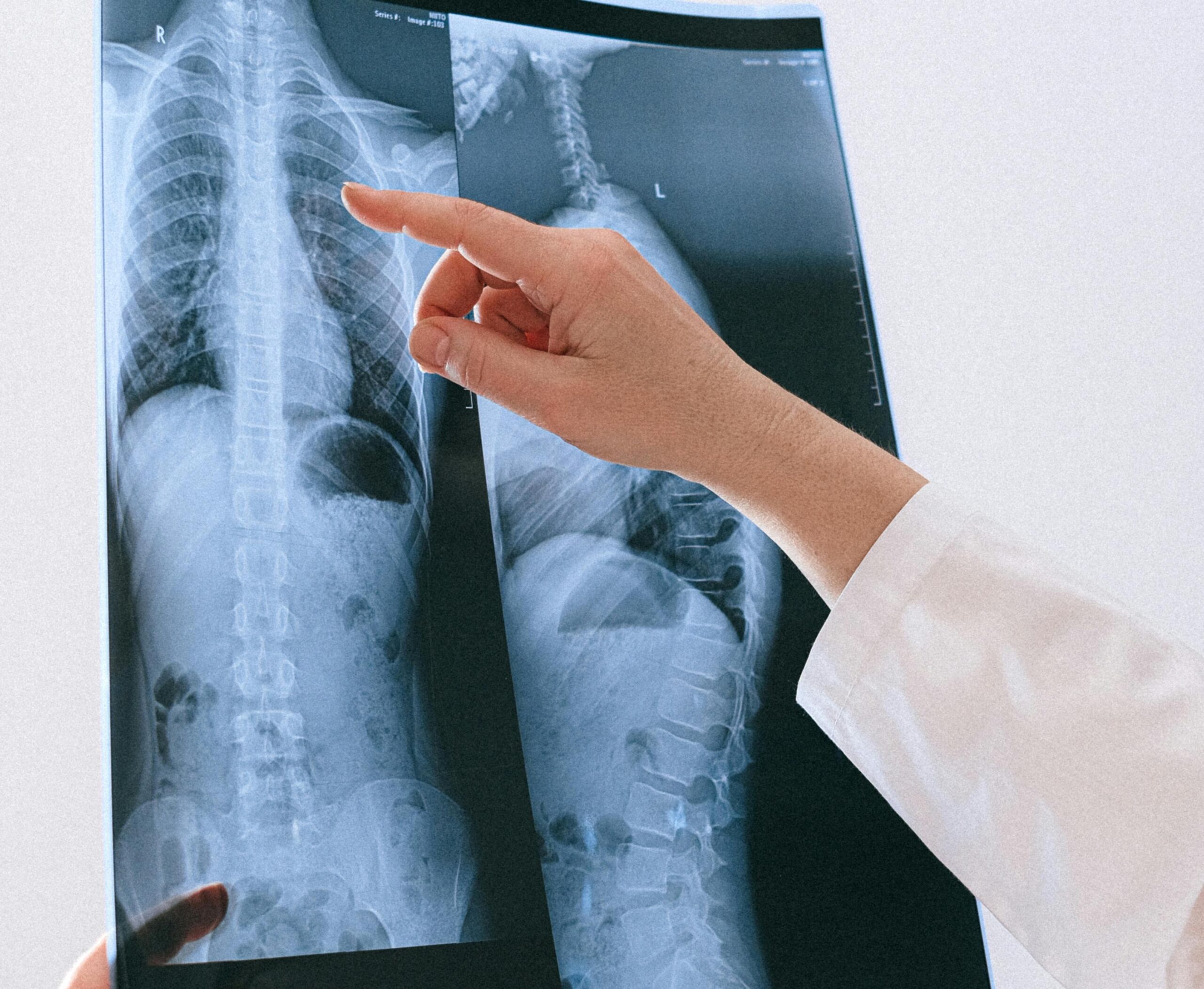 Amerikanische Chiropraktik